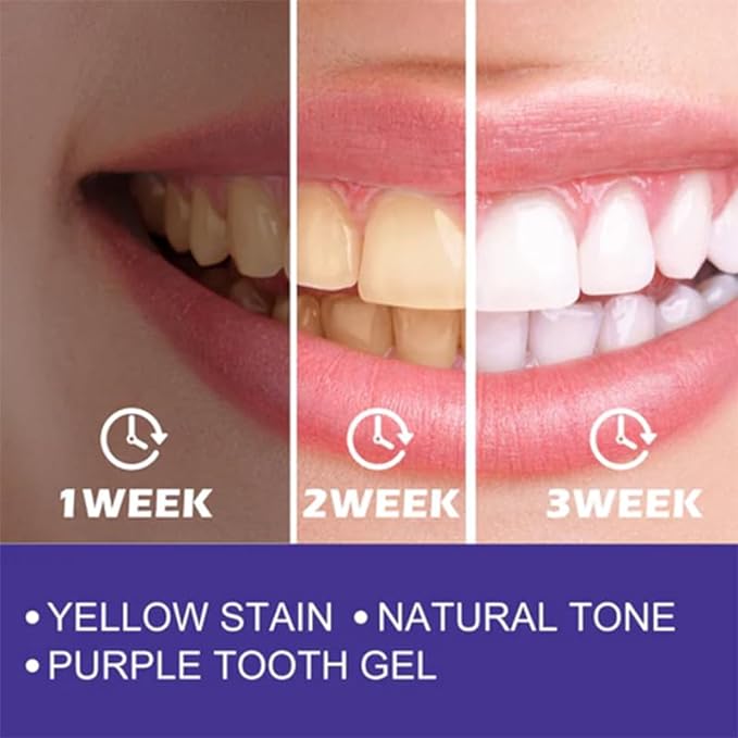 Purple Whitening Toothpaste™ (2Pices) ! ™معجون الأسنان الأرجواني